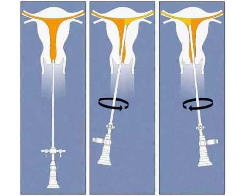 东莞代怀网品牌,东莞广济医院试管价格是多少单周期助孕需花费30至50万元