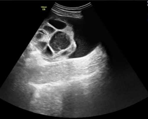 东莞试管成功率最高的地方,东莞十大生殖医院排名榜，试管婴儿成功率正式公