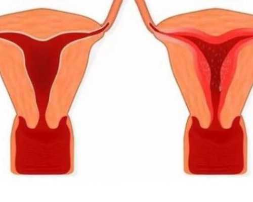 东莞热门助孕机构推荐，做试管需要什么条件