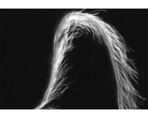 东莞试管移植成功经验视频