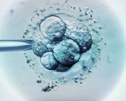 东莞哪里试管婴儿,东莞精子库,东莞有没有精子库