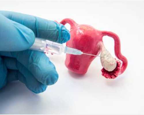 东莞哪家借卵生子机构好？正规供卵机构名单推荐