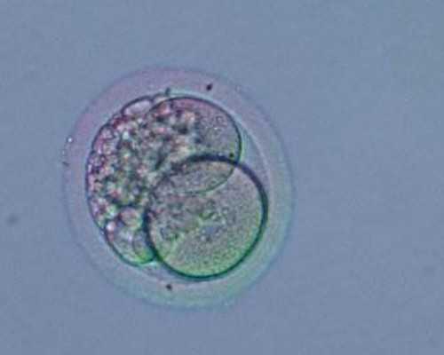 二代试管性别_泰国捐卵试管,试管自费可以报销吗,三代试管可以报销吗