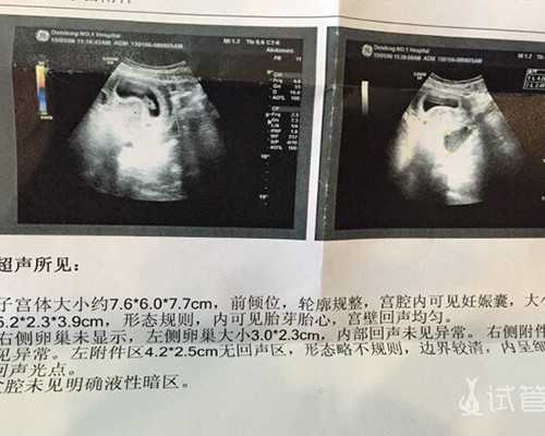 东莞靠谱的代怀公司,东莞2026试管助孕机构名单大全！剖析试管助孕成功率及相