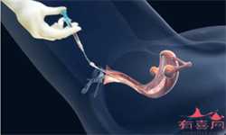 中国助孕机构_孕晚期胎动在左边是男孩女孩